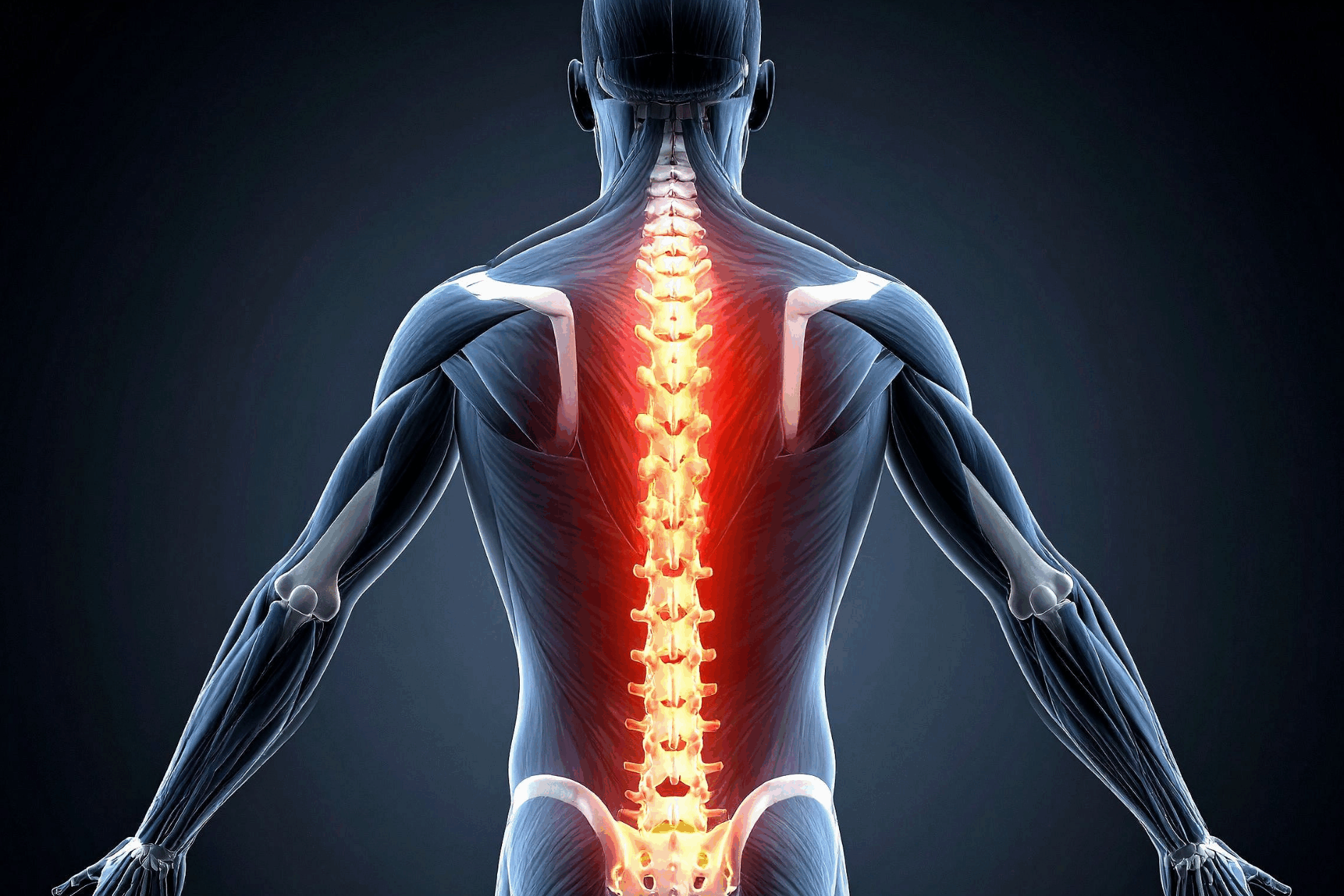 spinal cord stimulation