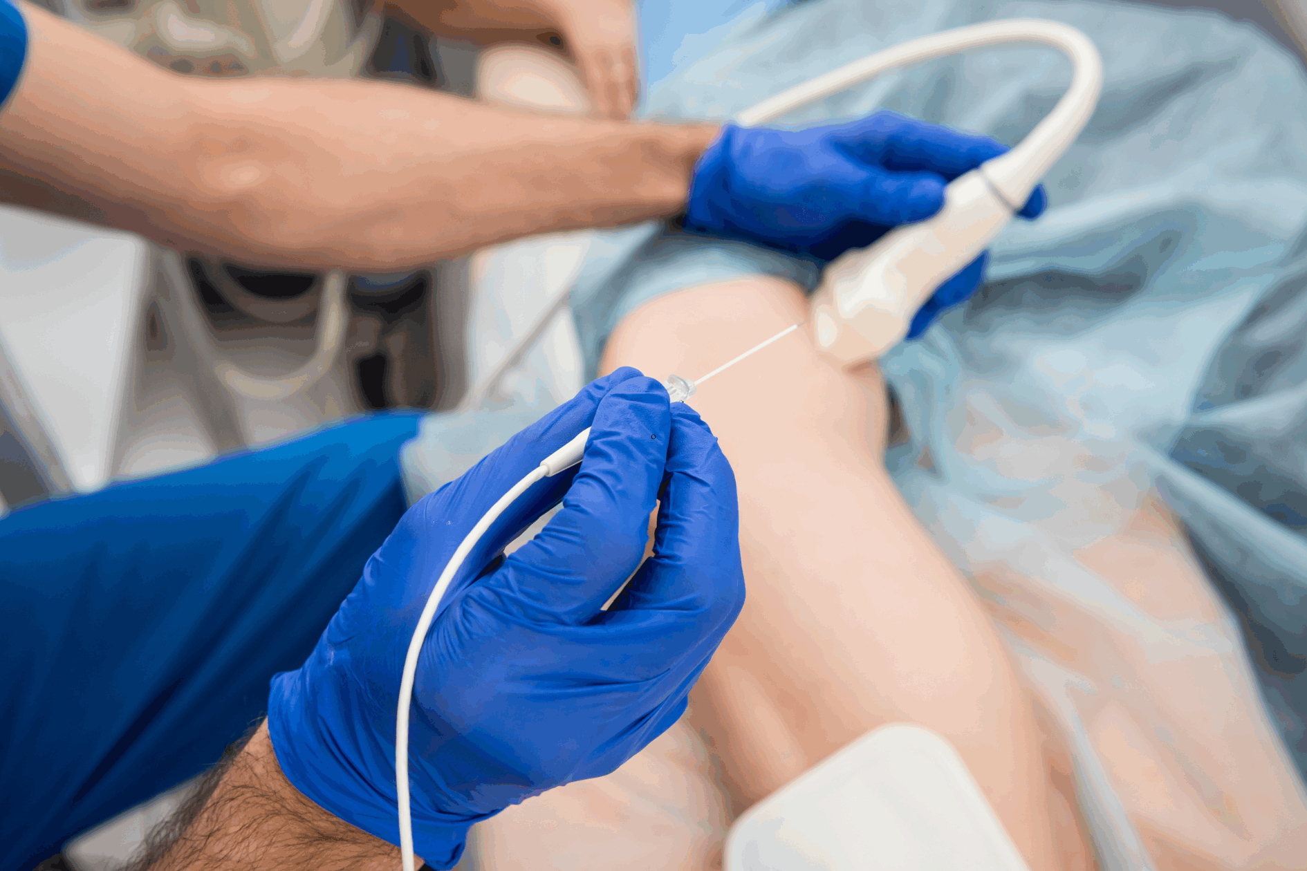 radiofrequency ablation minimally invasive pain relief