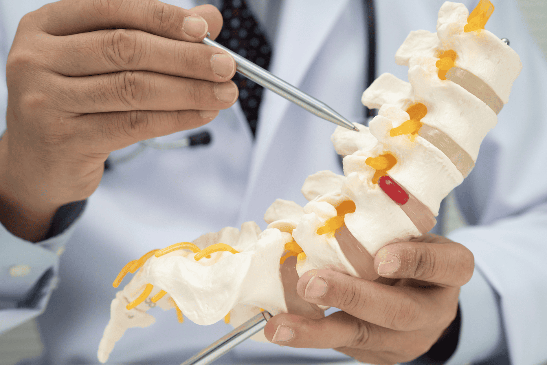 degenerative disc disease